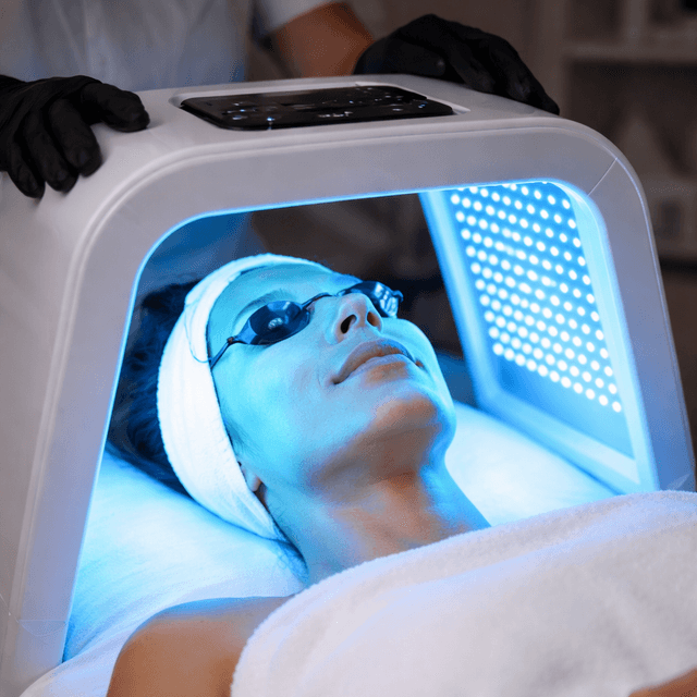 ACNE TREATMENT at Brazilian Beauty Wax Studio in Columbus, OH